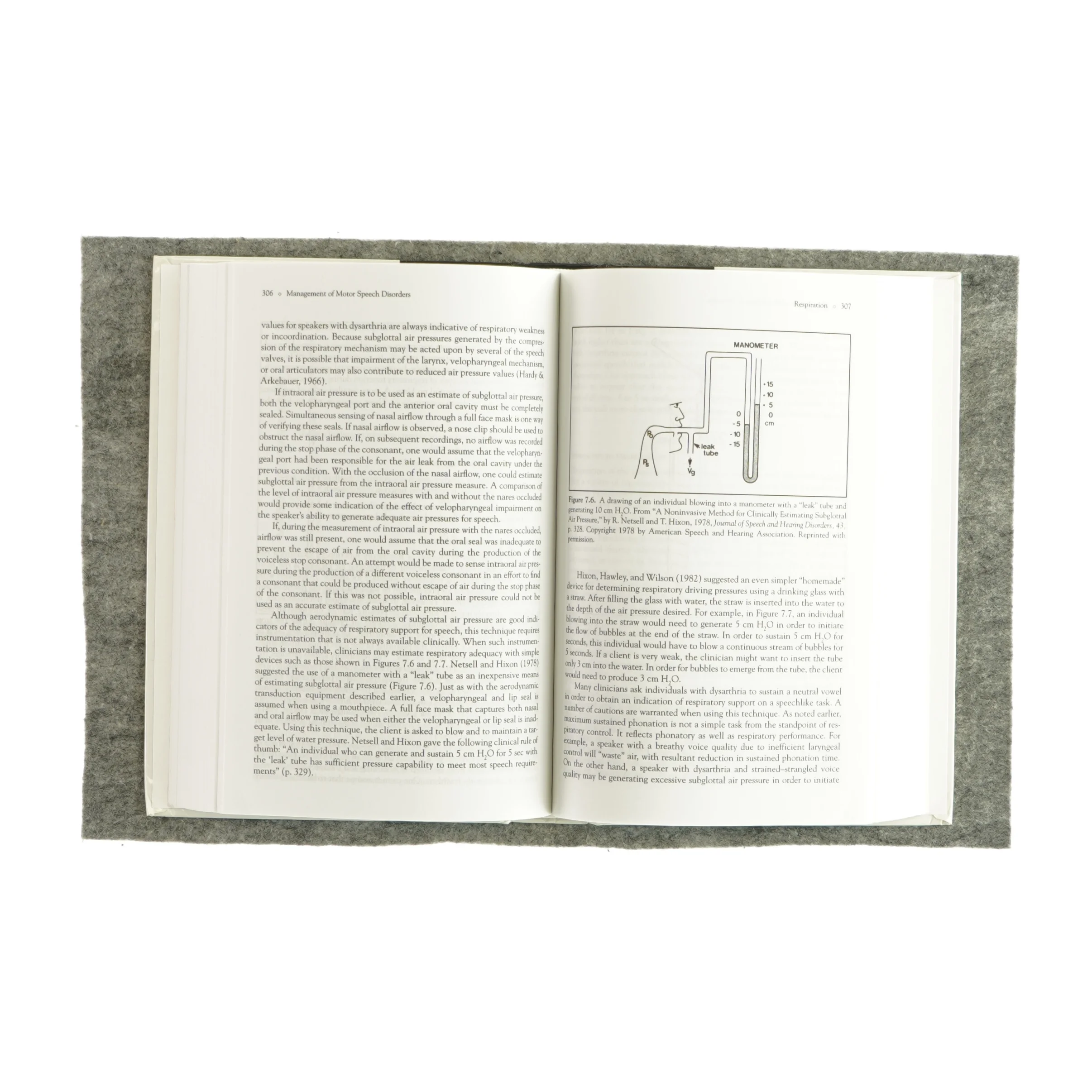 Management of  motor speech disorders in children and adults (Bog)